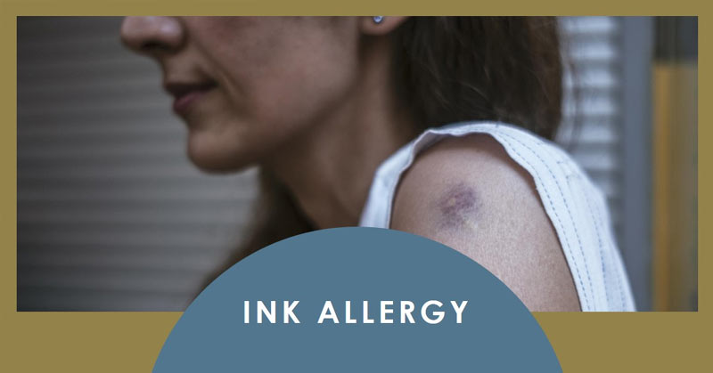 What Is Ink Allergy